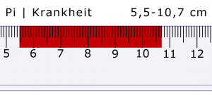 Feng Shui Lineal: Pi Krankheit